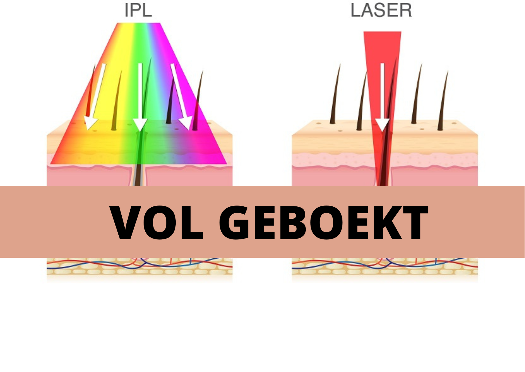 Opleiding Ontharen met licht - Groep BlooMEDical- start 3 okt. 2023