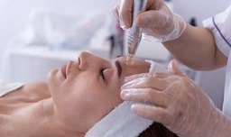 Microneedling