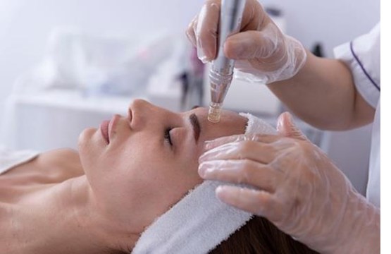 Workshop Kennismaking met Microneedling - 26 mei 2026
