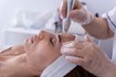 Workshop Kennismaking met Microneedling - 26 mei 2026 2