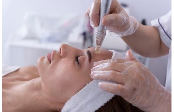 Workshop Kennismaking met Microneedling - 26 mei 2026
