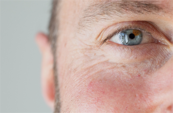 Masterclass IPL voor Pigment en Vasculaire indicaties - 25 jan. 2027